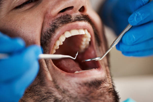 Best Wisdom Tooth Removal  in Wheelersburg, OH